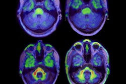 2022 03 21 15 25 7179 2022 03 17 Ac Immune Pet Image 400