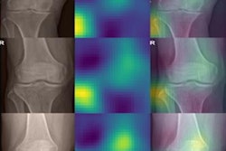 2022 03 23 16 38 2947 2022 03 24 Ai X Ray Side Markers 400