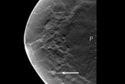 2022 03 29 14 28 5753 2022 03 29 Rsna Ai Mammo Scores C 400