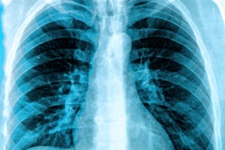 2017 12 01 19 30 7318 X Ray Chest Lungs 400b