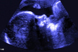 2019 04 15 22 11 5091 Fetal Ultrasound 400