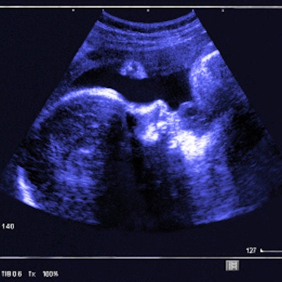 2019 04 15 22 11 5091 Fetal Ultrasound 400