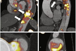 2022 04 01 14 06 4761 2022 04 01 Pet Aortic Syndrome 400