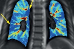 2022 04 06 17 22 5995 2022 04 11 Radiology Nyilas Image 400