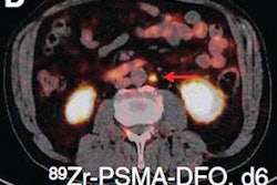 2022 04 11 01 14 0483 2022 04 11 Zr Psma 400