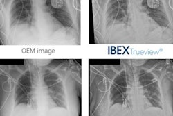 2022 04 21 18 14 3192 2022 04 22 Ibex Trueview 20220421181055