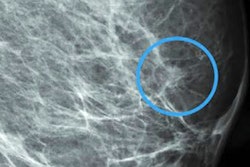 2022 04 22 21 20 1298 2022 04 24 Radiology Mammo Ai Workload Image B 400