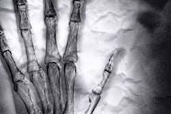 2013 10 07 12 39 24 825 X Ray Hand 200