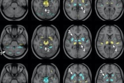 2022 04 29 15 43 1307 2022 04 22 Ai Pet Brain 20220429153218
