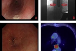 2022 04 30 00 57 4108 2022 04 29 Barium Swallows 20220430002214