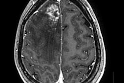 2022 05 08 19 01 6146 2022 05 08 Ismrm Zaharchuk Image2 400