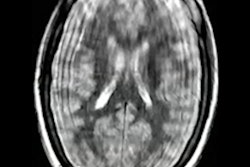 2022 05 09 21 28 6735 2022 05 09 Ismrm Simcock Mri Pediatric 400