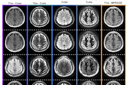 2022 05 10 18 21 1076 2022 05 10 Ismrm Mr Fingerprinting 400