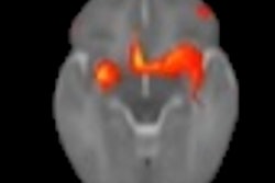 2022 05 12 02 02 1028 2022 05 12 Lebel Baby Brain Image 400