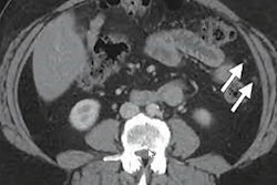 2022 05 12 14 52 6515 2022 05 11 Ismrm Mri Ct Ovarian Cancer 400