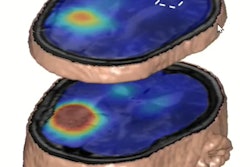 2022 05 16 23 49 2163 2022 05 12 Ismrm De Graaf Dmi 400