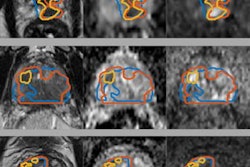 2022 05 23 17 23 0237 2022 05 25 Mri Insider Figure 1 20220523180206