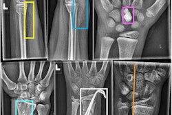 2022 05 23 18 33 9936 2022 05 23 Wrist Fractures 20220523185548