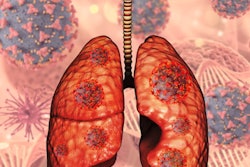 2022 05 27 21 58 0078 3 D Lungs Covid Virus Cells 400