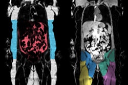 2019 01 08 21 25 8046 Amra Jpmorgan Slide2 400