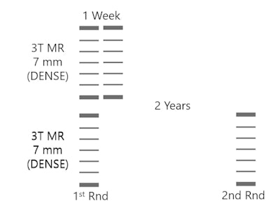 Sieve model of breast cancer screening for the two-year interval of the second round of the 3T MRI DENSE trial compared with a hypothetical model with only one week between screens. Courtesy of Keith Cover, PhD.