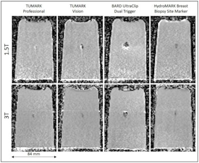 Maximum extent of the obtained artifacts for ADC maps.