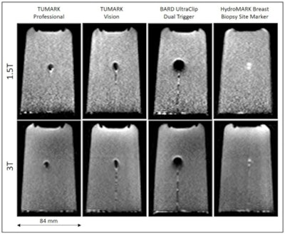 Maximum extent of the obtained artifacts for DWI images (b=800 s/mm2)