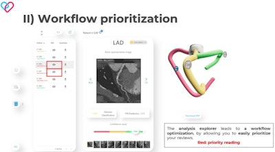 In the Coronary-Expert interface, the 'analysis explorer' allows doctors to optimize their reading workflow, by prioritizing red cases first.