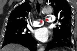 2022 06 14 22 40 9814 2022 06 14 Radiology Rogers Figure2 400