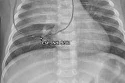 2022 06 23 22 08 7133 2022 06 21 Lunit Children 20220623225349