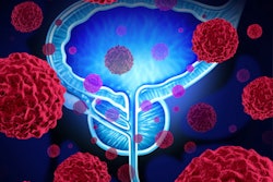 2021 07 13 16 11 0027 Prostate Cancer 400