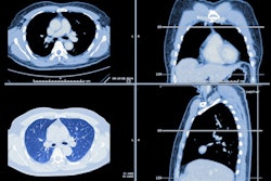 2021 09 13 18 08 1880 Lung Ct Images 400
