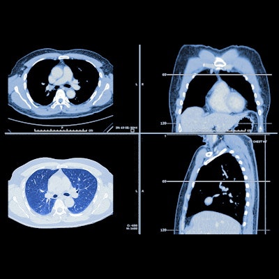 2021 09 13 18 08 1880 Lung Ct Images 400
