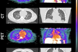 2022 06 30 21 02 6768 Functional Lung Imaging2 400
