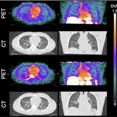 2022 06 30 21 02 6768 Functional Lung Imaging2 400