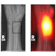 2022 07 07 17 08 0541 2022 07 08 Ukio X Ray Image 400