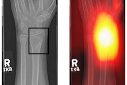 2022 07 07 17 08 0541 2022 07 08 Ukio X Ray Image 400