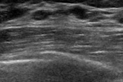 2022 07 12 04 12 6241 Breast Ultrasound 400