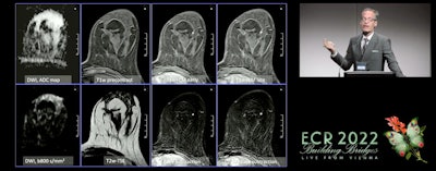 Dr. Pascal Baltzer from the Medical University of Vienna talked about breast MRI's outlook for 2025. He said shorter protocols incorporating diffusion-weighted imaging and machine learning can help improve image quality and detection of malignancies. Images courtesy of the ECR.