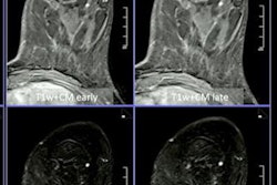 2022 07 13 22 28 0115 2022 07 13 Ecr Mri Breast Imaging 20220713220247