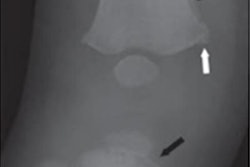 2022 07 18 15 58 5749 2022 07 14 Cml Cd 400