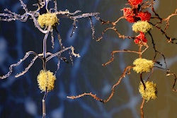 2022 08 01 17 23 7516 Alzheimers Phases Amyloid 400
