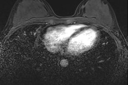 2022 08 02 15 04 1777 2022 07 26 Radiology Dce Mri Chemotherapy Predictors Image C 400