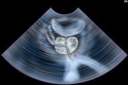 2022 08 02 21 12 6467 Ultrasound Scan Prostate 400