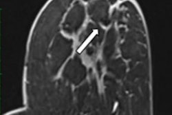 2022 08 03 17 58 2967 2022 08 03 Ejr Hugot Breast Mri Figure1 20220803170647