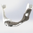 2022 08 09 17 54 8196 2022 08 09 Nci Titanium Jaw 400