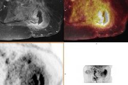 2022 08 10 23 14 4662 2022 08 10 Pet Mri Osteomyelitis 20220810232723