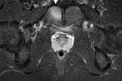 2022 08 17 23 06 6514 2022 08 22 Mri Olympics 1 400