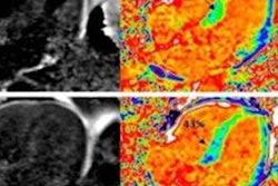 2022 08 25 20 15 9224 2022 07 29 Mri Cmr T1 Ecv Mapping 20220825203046