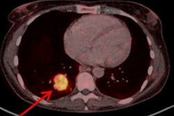 2022 08 28 17 28 7602 2022 08 25 Net Tracer 400